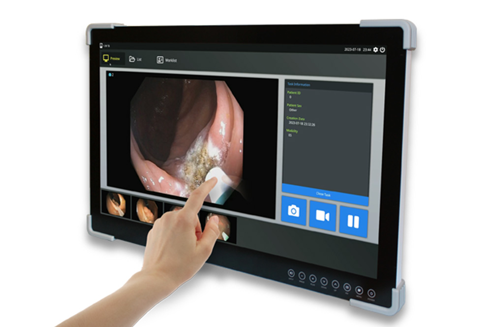 FSN FS-A2702DST 27″ FHD Medical Touch monitor 