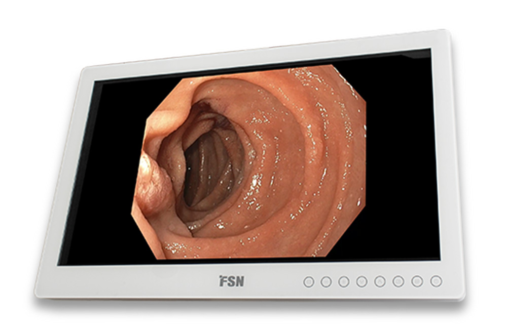 FSN FS-E2102D 21,5″ FHD Medical Monitor