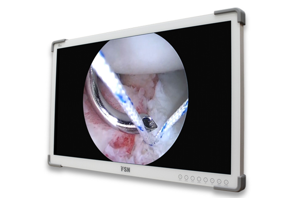 FSN FS-A3202DS 32″ FHD Medical Monitor