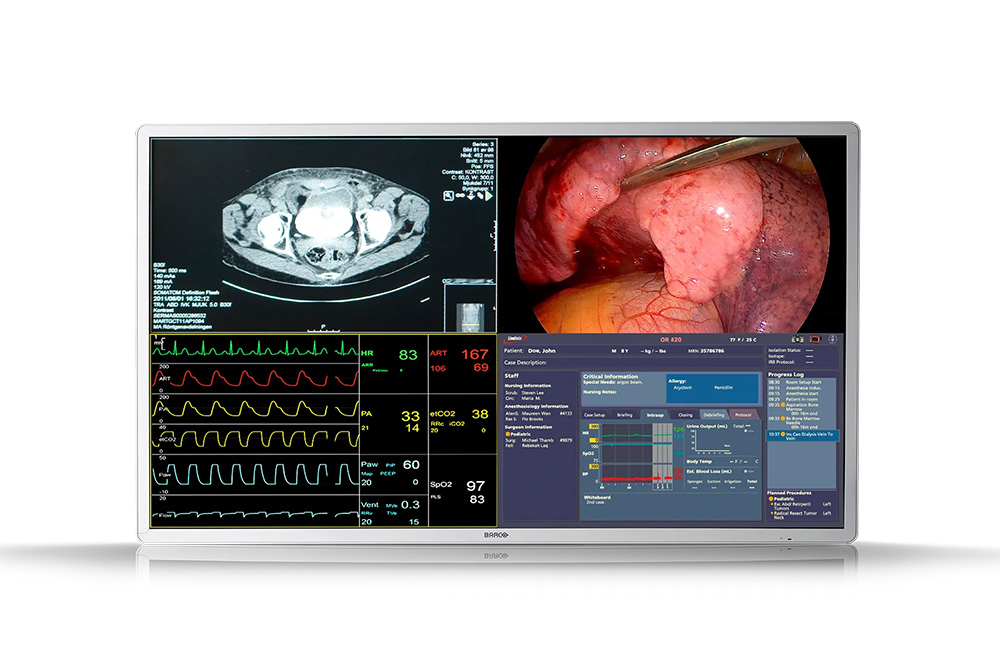 Surgical Monitor Barco MDSC-8255 12G-SDI