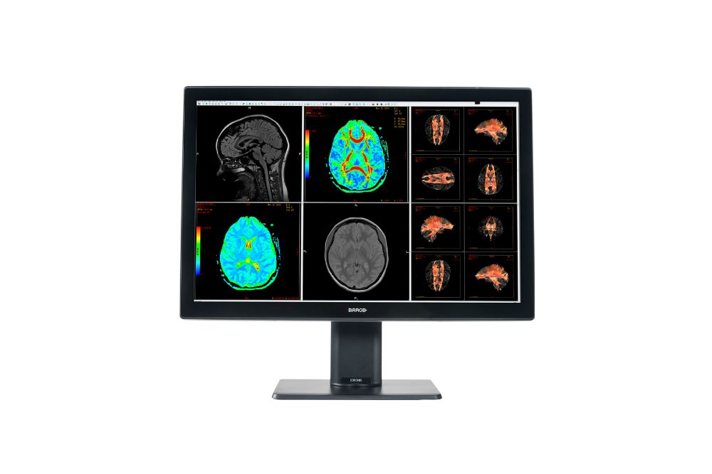 Barco Coronis Fusion 6MP 30" 1H1F (MDCC-6530)
