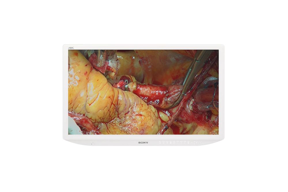 Sony LMD-X3200MD 32" 4K/2D/LCD Medical Monitor