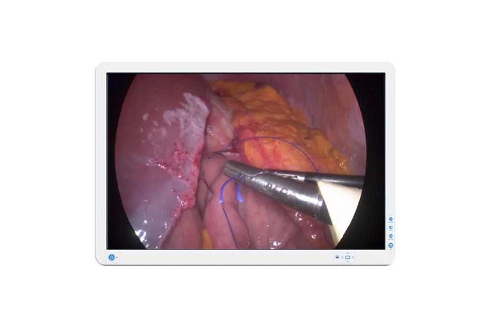 Surgical Display Barco AMM240ED