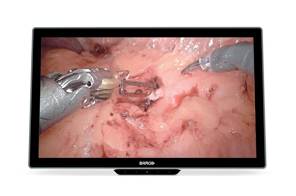 Surgical Monitor Barco MDSC-8527 SSTF M2