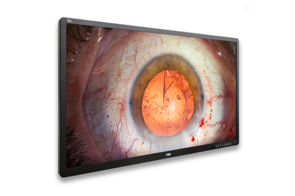 FSN FM-A5505DGC 55" Medical 4K 3D Monitor