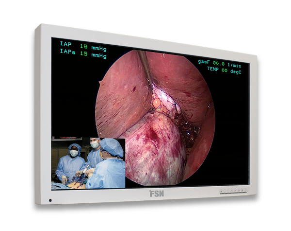 FSN FS-L3202D 32″ HD Medical Monitor