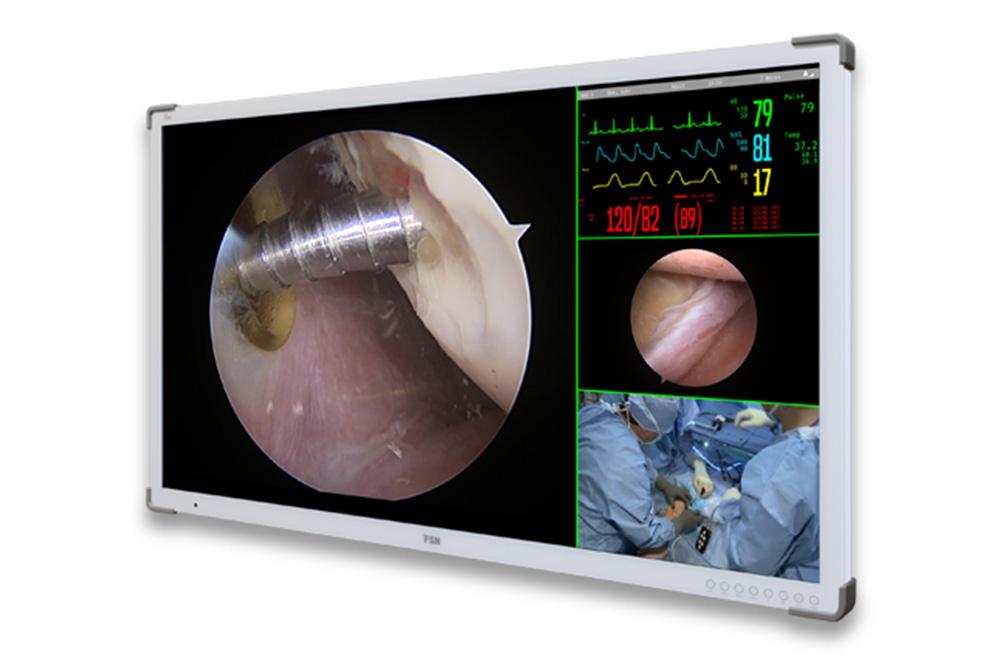 FSN FM-A5504DG 55", 4K UHD Medical Monitor
