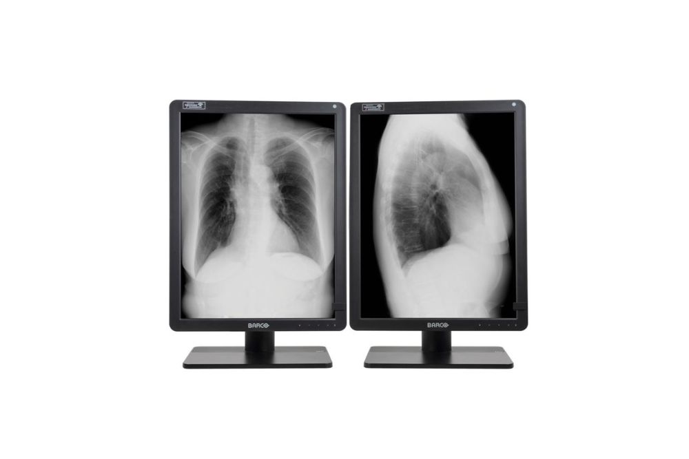 Barco Nio Gray 5.8MP 21" 2H2F (MDNG‑6221) 