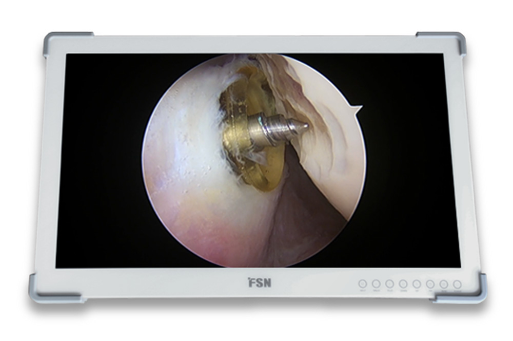 FSN FS-A2702DS 27″ FHD Medical Monitor