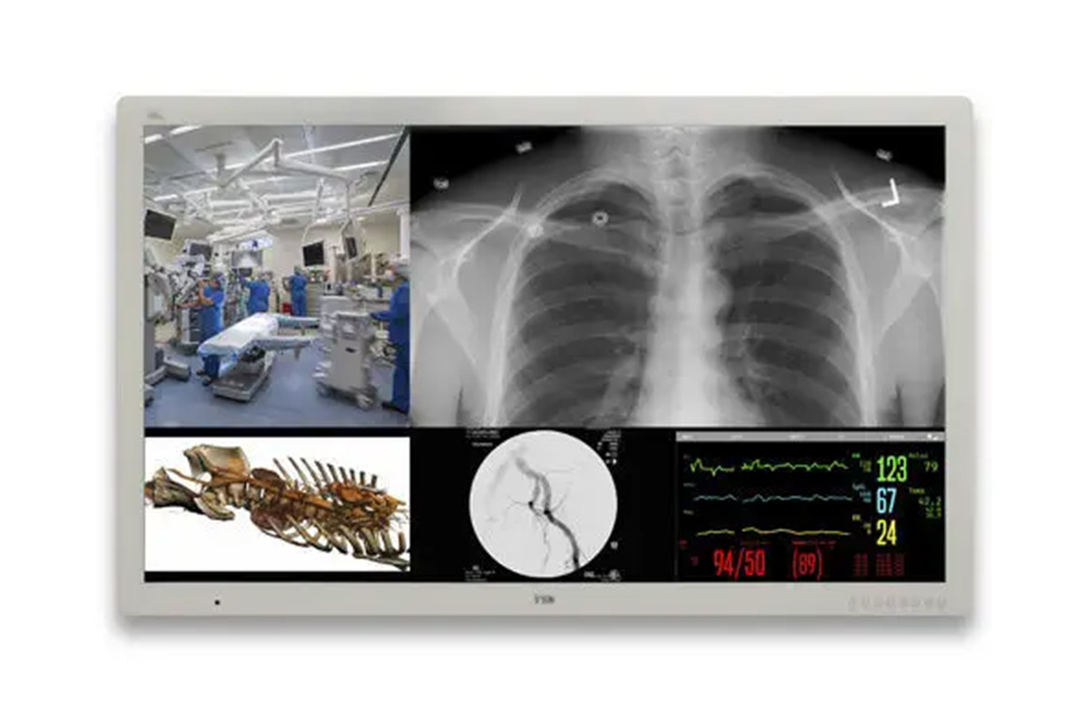 FSN FM-D5801DV 58" 4K Medical Monitor